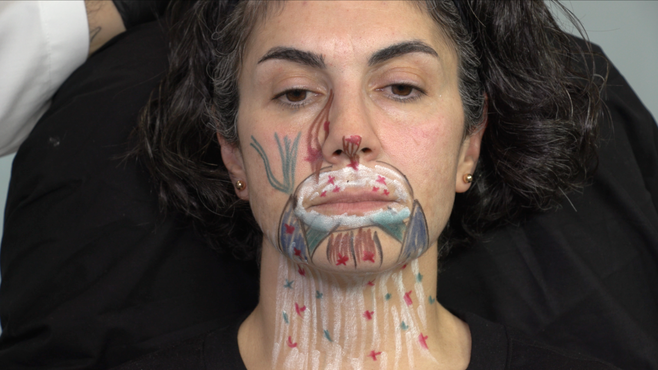 Reha Botox Thumbnail Modul 3