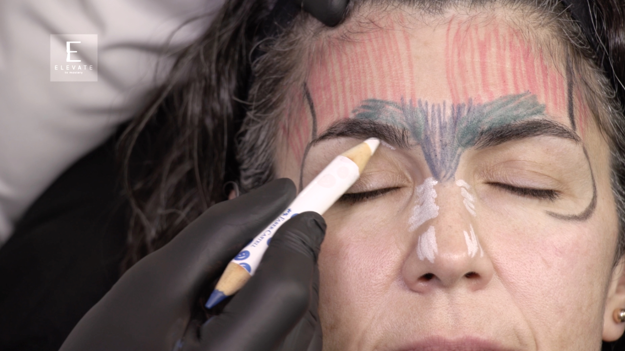 Reha Thumbnail Botox 1