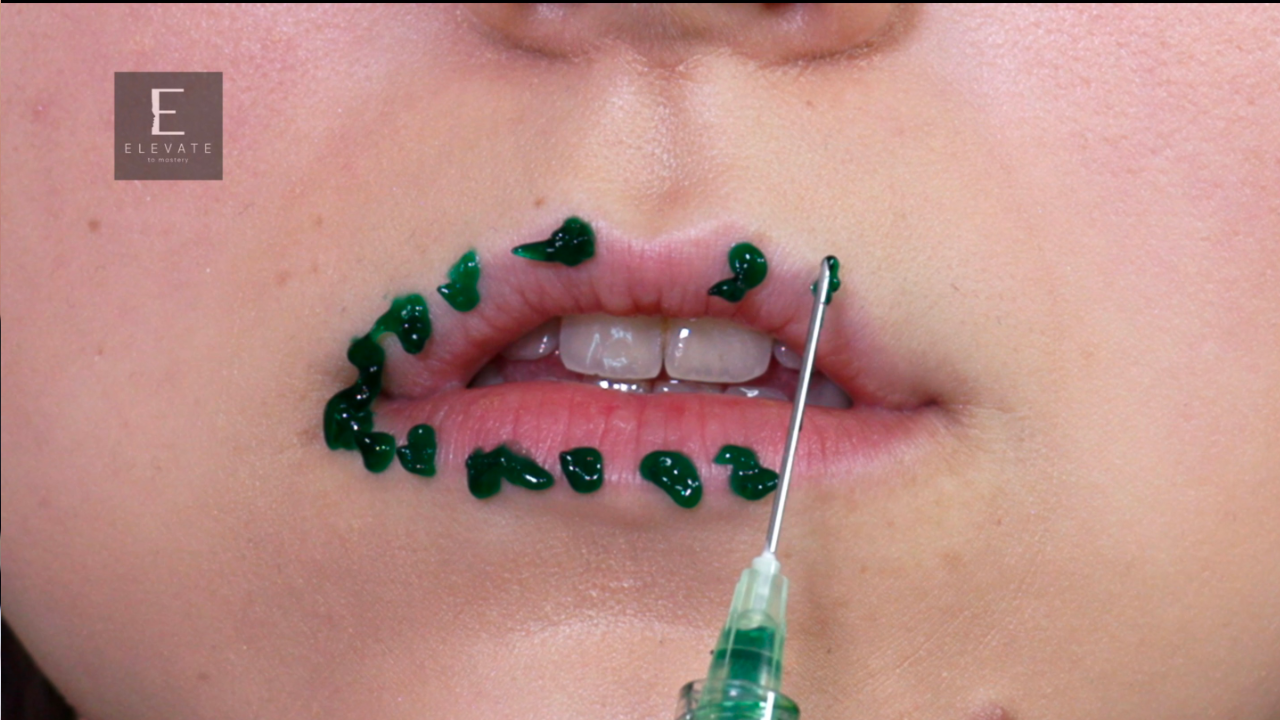 Thumbnail Reha Lips 1
