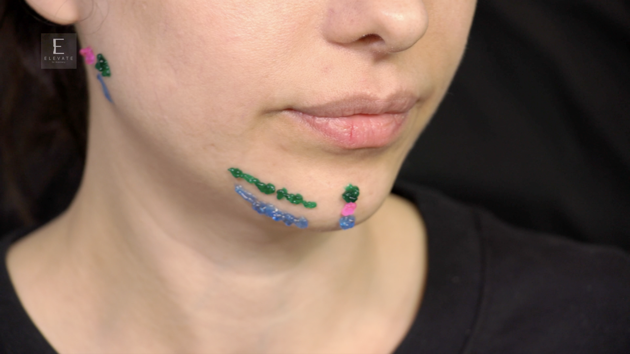 Lower Face Fillers Reha Thumbnail Part 1