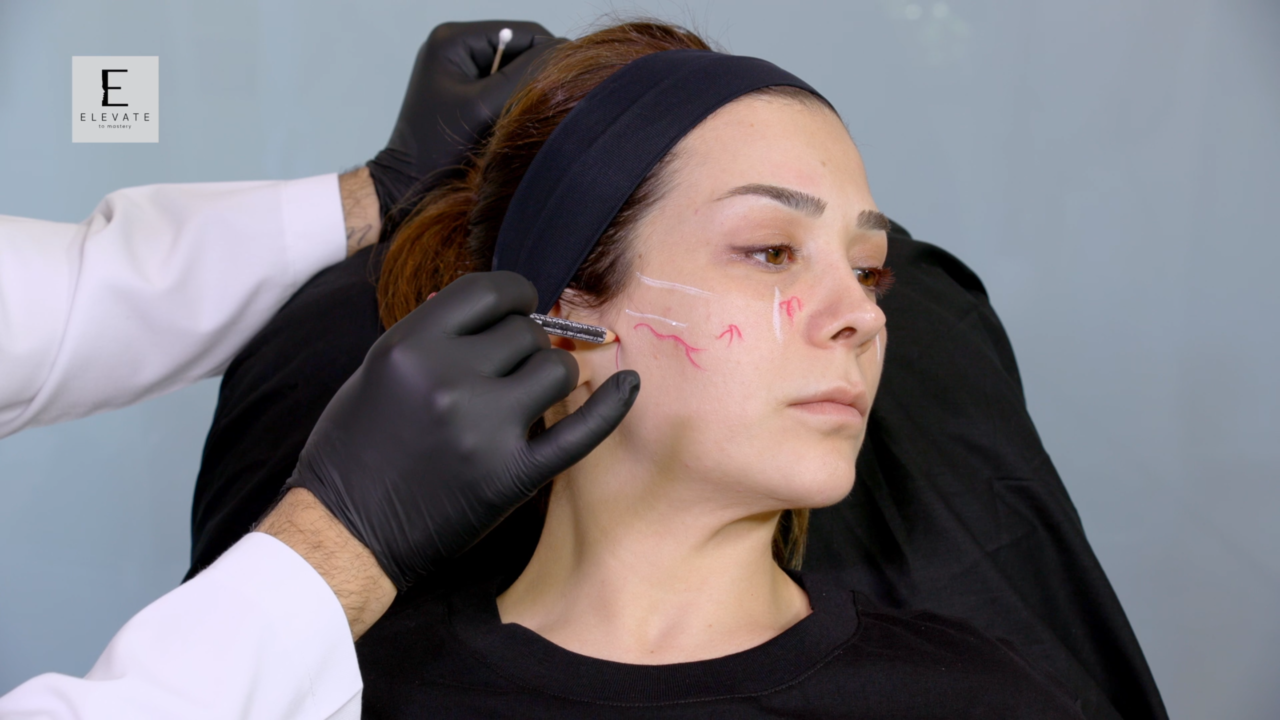 Module 1 See Before You Treat. Midface Assessment & Anatomical Mapping