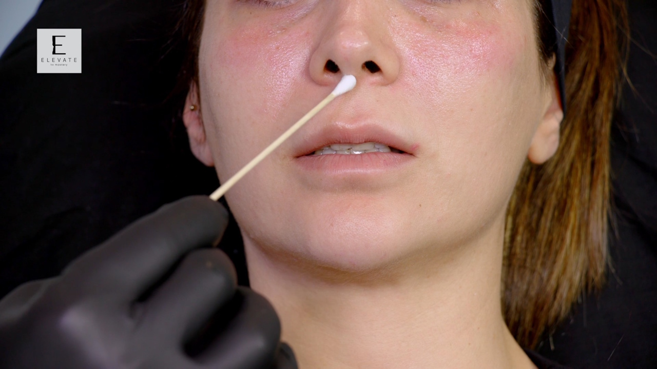 Module 3 When The Upper Lip Is The Challenge. Treatment Strategy And Execution