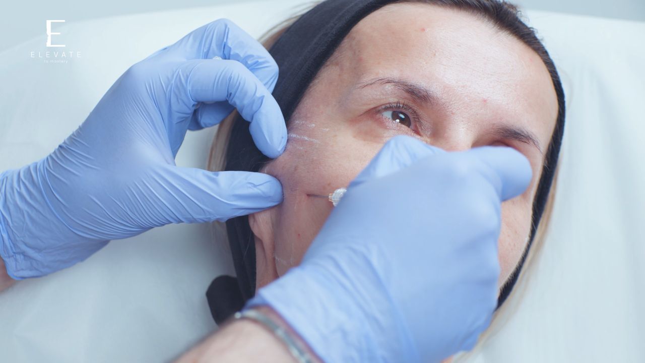 Setting The Stage. Biostimulator Treatment