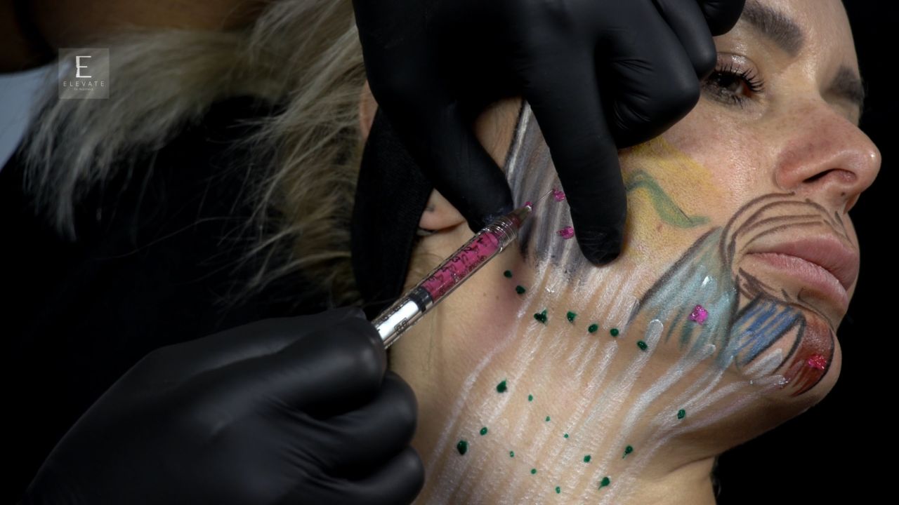 Lower Face And Neck Applied Anatomy For Lower Face & Neck Neurotoxin Treatment