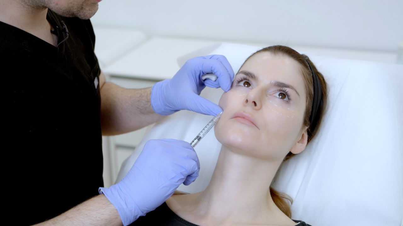 Thumbnail Executing The Treatment Plan Facial Softening & Harmonization Anteromedial Cheek, Nlf & Lips