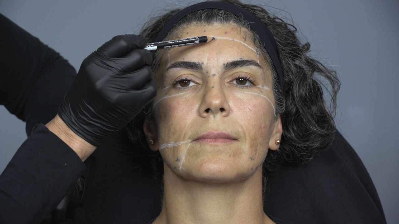 17 Case 2 Revisited Full Face Assessment A Different Expert Approach To Asymmetry