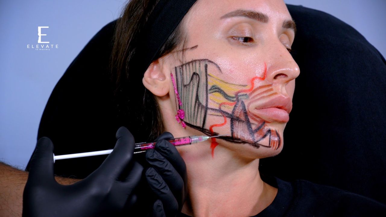 Jawline & Chin For Ha Fillers